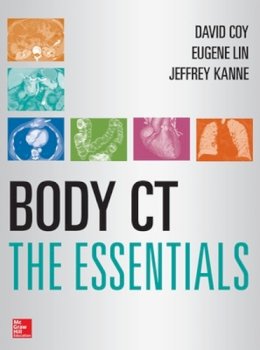 Lin, Eugene, Coy, David, Kanne, Jeffrey - Body CT The Essentials - 9780071767385 - V9780071767385