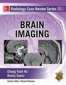 Ho, Chang; Saenz, Rocky - Radiology Case Review Series: Brain Imaging - 9780071826914 - V9780071826914