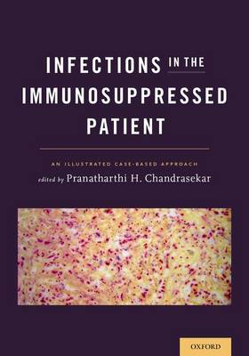 Pranatharthi H. . Ed(S): Chandrasekar - Infections in the Immunosuppressed Patient - 9780199938568 - V9780199938568