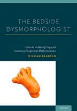 William Reardon - The Bedside Dysmorphologist - 9780199970889 - V9780199970889