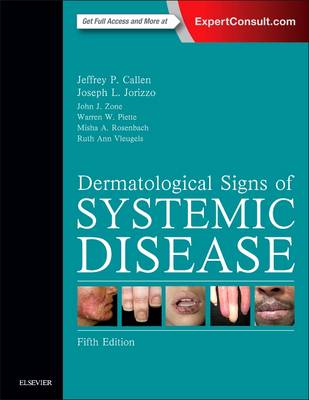 Jeffrey P. Callen - Dermatological Signs of Systemic Disease - 9780323358293 - V9780323358293