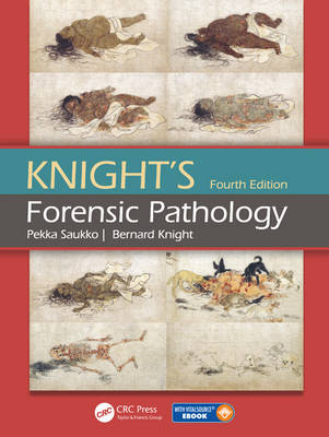 Pekka J. Saukko - Knight´s Forensic Pathology - 9780340972533 - V9780340972533