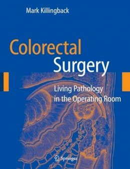 Mark Killingback - Colorectal Surgery - 9780387290812 - V9780387290812