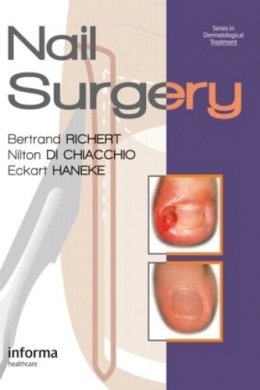 Bertrand Richert - Nail Surgery - 9780415472333 - V9780415472333