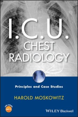 Harold Moskowitz - I.C.U. Chest Radiology: Principles and Case Studies - 9780470450345 - V9780470450345