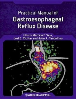 Marcelo F. Vela - Practical Manual of Gastroesophageal Reflux Disease - 9780470656266 - V9780470656266