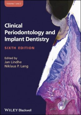 Niklaus P. Lang (Ed.) - Clinical Periodontology and Implant Dentistry, 2 Volume Set - 9780470672488 - V9780470672488