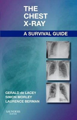 Gerald de Lacey - The Chest X-Ray, a Survival Guide - 9780702030468 - V9780702030468