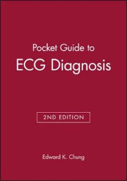 Edward K. Chung - Pocket Guide to ECG Diagnosis - 9780865425897 - V9780865425897