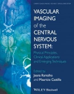 Joana Ramalho (Ed.) - Vascular Imaging of the Central Nervous System: Physical Principles, Clinical Applications, and Emerging Techniques - 9781118188750 - V9781118188750