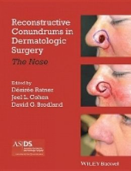 Desiree S. Ratner - Reconstructive Conundrums in Dermatologic Surgery: The Nose - 9781118272329 - V9781118272329