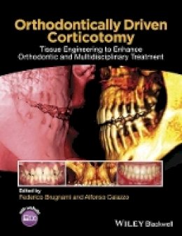 Federico Brugnami - Orthodontically Driven Corticotomy: Tissue Engineering to Enhance Orthodontic and Multidisciplinary Treatment - 9781118486870 - V9781118486870
