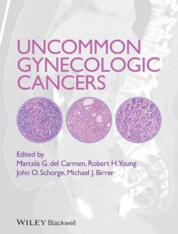 Marcela Del Carmen (Ed.) - Uncommon Gynecologic Cancers - 9781118655351 - V9781118655351