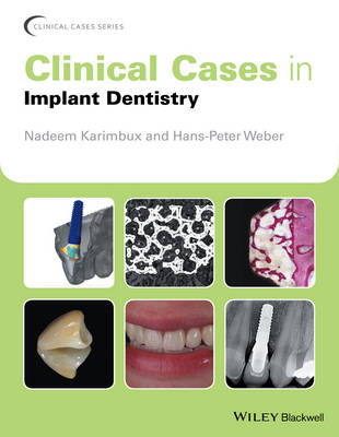 Nadeem Karimbux - Clinical Cases in Implant Dentistry - 9781118702147 - V9781118702147