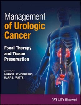 Mark P. Schoenberg - Management of Urologic Cancer: Focal Therapy and Tissue Preservation - 9781118864623 - V9781118864623