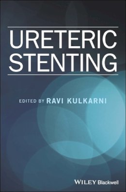 Ravi S. Kulkarni - Ureteric Stenting - 9781119085683 - V9781119085683