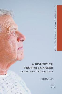 Helen K. Valier - A History of Prostate Cancer: Cancer, Men and Medicine - 9781403988034 - V9781403988034