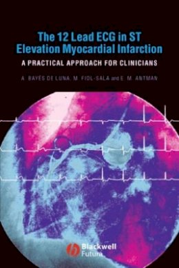 Antoni Bayés de Luna - The 12 Lead ECG in ST Elevation Myocardial Infarction: A Practical Approach for Clinicians - 9781405157865 - V9781405157865