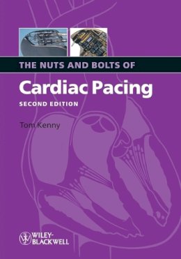 Tom Kenny - The Nuts and Bolts of Cardiac Pacing - 9781405184038 - V9781405184038