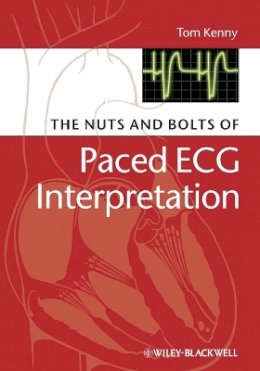 Tom Kenny - The Nuts and Bolts of Paced ECG Interpretation - 9781405184045 - V9781405184045