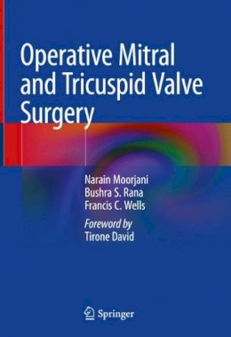 Narain Moorjani - Operative Mitral and Tricuspid Valve Surgery - 9781447142034 - V9781447142034