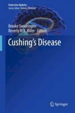 Brooke Swearingen (Ed.) - Cushing´s Disease - 9781461428312 - V9781461428312