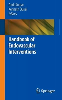 Amit Kumar - Handbook of Endovascular Interventions - 9781461450122 - V9781461450122