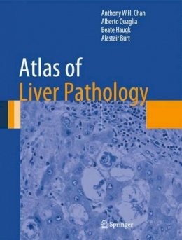 Anthony W.H. Chan - Atlas of Liver Pathology - 9781461491132 - V9781461491132