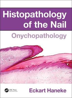 Eckart Haneke - Histopathology of the Nail: Onychopathology - 9781482212327 - V9781482212327