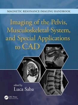 Luca Saba - Imaging of the Pelvis, Musculoskeletal System, and Special Applications to CAD - 9781482216219 - V9781482216219