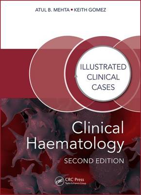 Atul Bhanu Mehta - Clinical Haematology: Illustrated Clinical Cases - 9781482243796 - V9781482243796