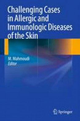 Massoud Mahmoudi (Ed.) - Challenging Cases in Allergic and Immunologic Diseases of the Skin - 9781489981813 - V9781489981813