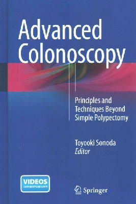 N/A - Advanced Colonoscopy: Principles and Techniques Beyond Simple Polypectomy - 9781493915835 - V9781493915835