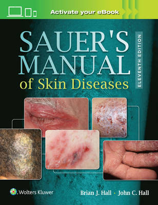 Brian J. Hall - Sauer´s Manual of Skin Diseases - 9781496329936 - V9781496329936