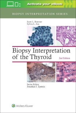 Scott L. Boerner - Biopsy Interpretation of the Thyroid - 9781496355850 - V9781496355850