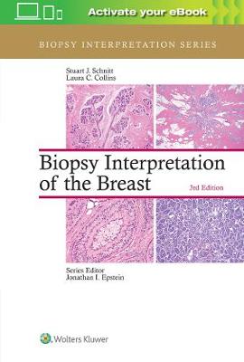 Stuart J. Schnitt - Biopsy Interpretation of the Breast - 9781496365750 - V9781496365750