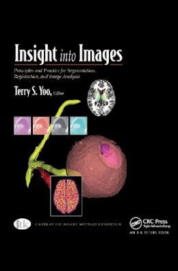 Terry S. Yoo - Insight into Images - 9781568812175 - V9781568812175