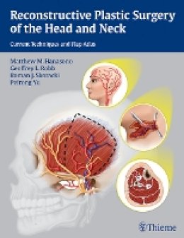 Matthew M. Hanasono - Reconstructive Plastic Surgery of the Head and Neck: Current Techniques and Flap Atlas - 9781604068078 - V9781604068078