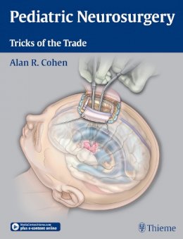 Alan R. Cohen - Pediatric Neurosurgery: Tricks of the Trade - 9781604068696 - V9781604068696