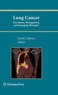 David J. Stewart (Ed.) - Lung Cancer:: Prevention, Management, and Emerging Therapies - 9781617796845 - V9781617796845