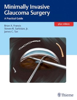 Brian Francis - Minimally Invasive Glaucoma Surgery: A Practical Guide - 9781626231566 - V9781626231566