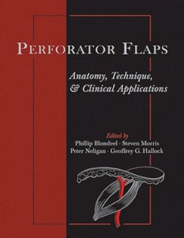 Phillip N. Blondeel - Perforator Flaps: Anatomy, Technique, & Clinical Applications - 9781626236097 - V9781626236097