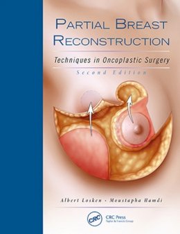 Albert Losken - Partial Breast Reconstruction: Techniques in Oncoplastic Surgery - 9781626236912 - V9781626236912