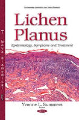 Yvonnel Summers - Lichen Planus: Epidemiology, Symptoms & Treatment - 9781634835411 - V9781634835411