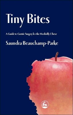 Saundra Beauchamp-Parke - Tiny Bites: A Guide to Gastric Surgery for the Morbidly Obese - 9781843107040 - V9781843107040