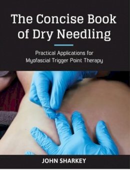 John Sharkey - The Concise Book of Dry Needling: A Practitioner's Guide to Myofascial Trigger Point Applications - 9781905367672 - V9781905367672