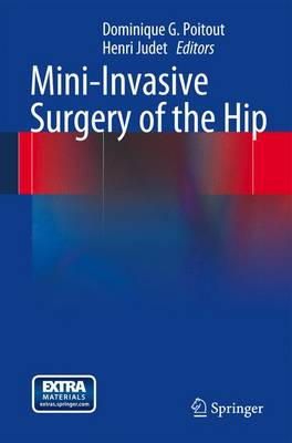 Dominique G. Poitout (Ed.) - Mini-invasive Surgery of the Hip - 9782287799303 - V9782287799303