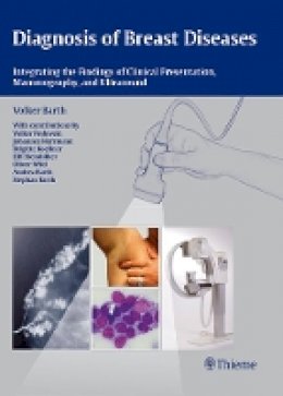 Volker Barth - Diagnosis of Breast Diseases: Integrating the Findings of Clinical Presentation, Mammography, and Ultrasound - 9783131438317 - V9783131438317