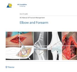 Jesse Jupiter - AO Manual of Fracture Management - 9783131492715 - V9783131492715