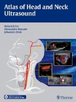 Heinrich Iro - Atlas of Head and Neck Ultrasound - 9783131603517 - V9783131603517